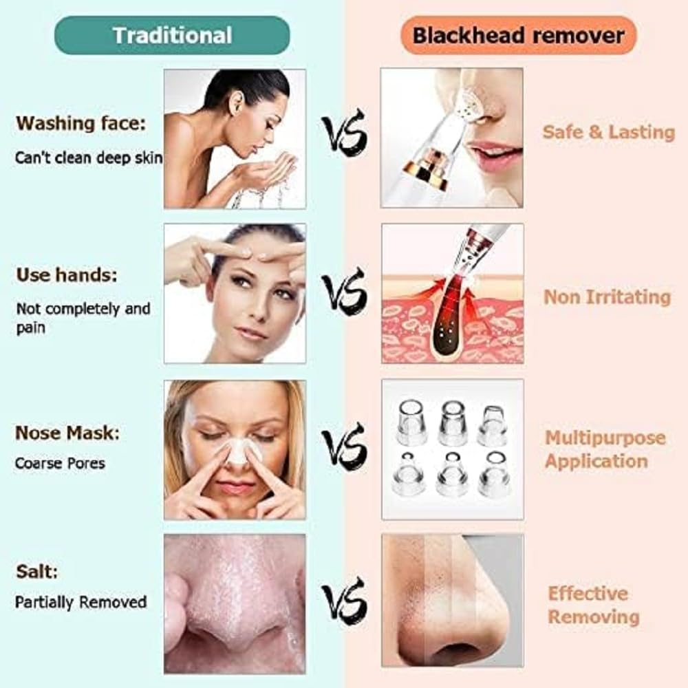 Remove Blackhead Device