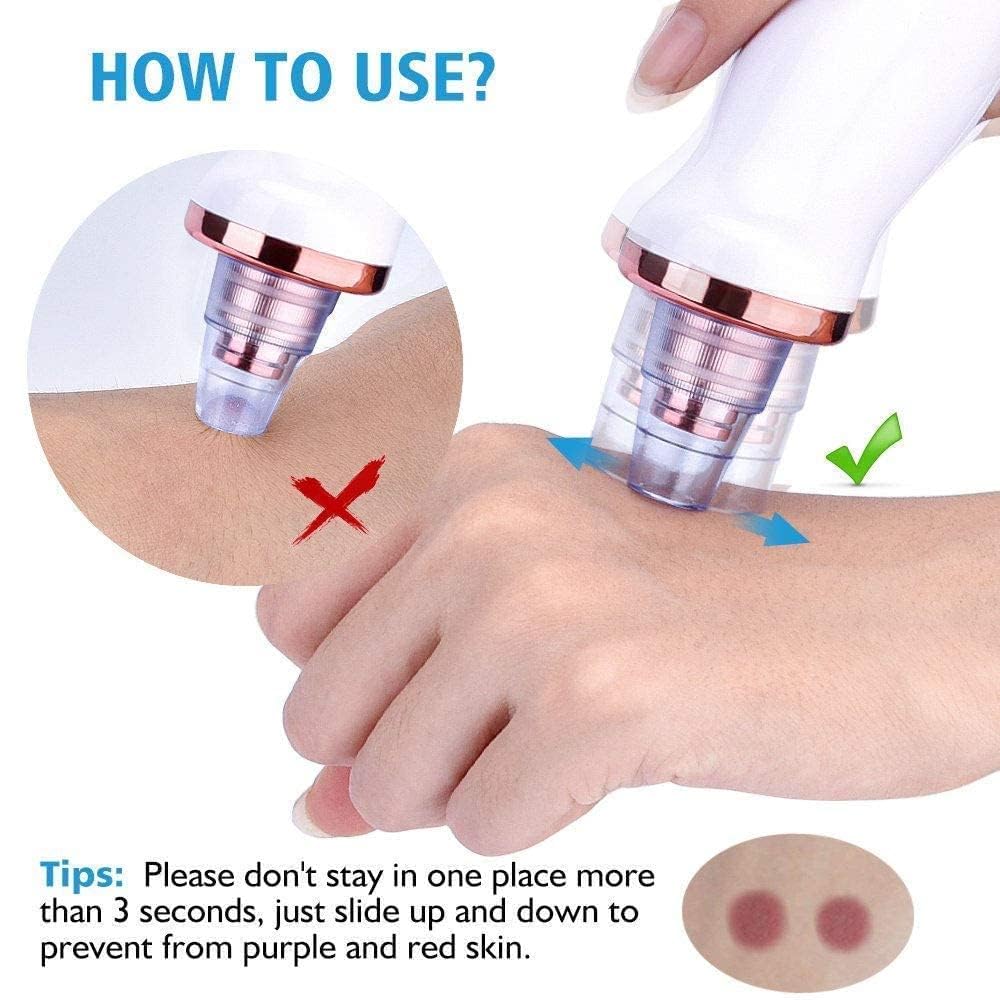 Remove Blackhead Device